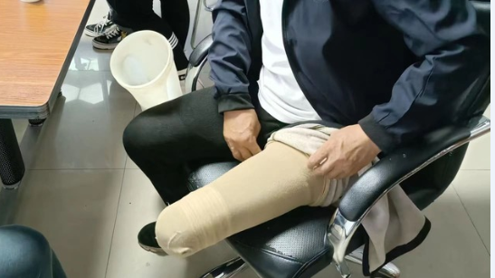 来自乌兰察布市的膝离断假肢客户